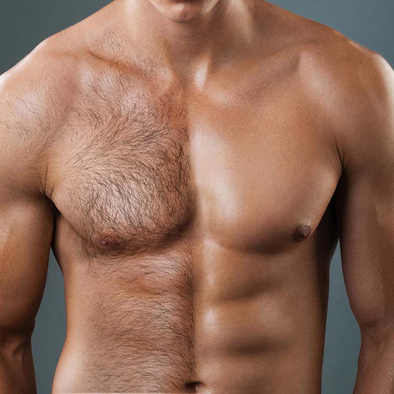 Are guys hairy why Here's What